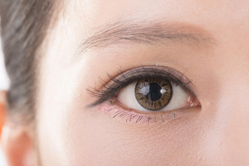 Góc thắc mắc: Lấy mỡ thừa mí mắt trên có tác dụng gì?