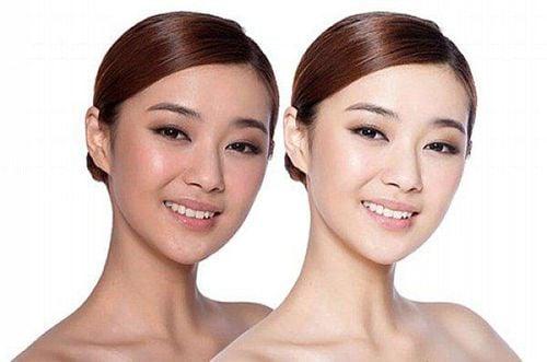 Đắp mặt nạ sữa tươi không đường mỗi ngày có tốt không?