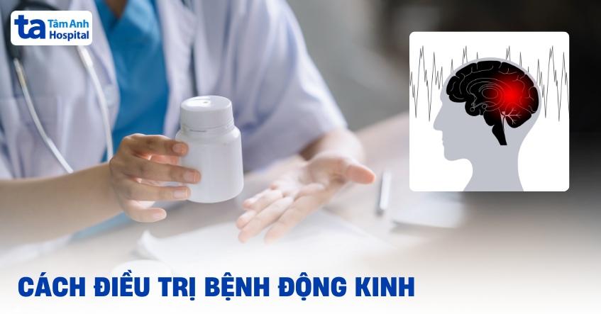 cách điều trị bệnh động kinh